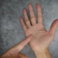 後遺障害の認定基準「手のひら大」とは？条件や面接についても解説
