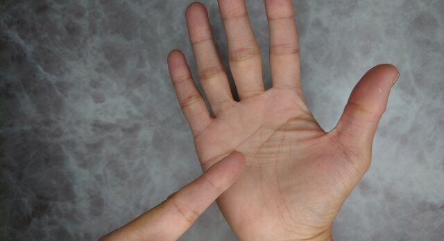 後遺障害の認定基準「手のひら大」とは？条件や面接についても解説